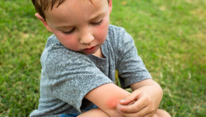 Young child examining red bug bite on arm while sitting in grass