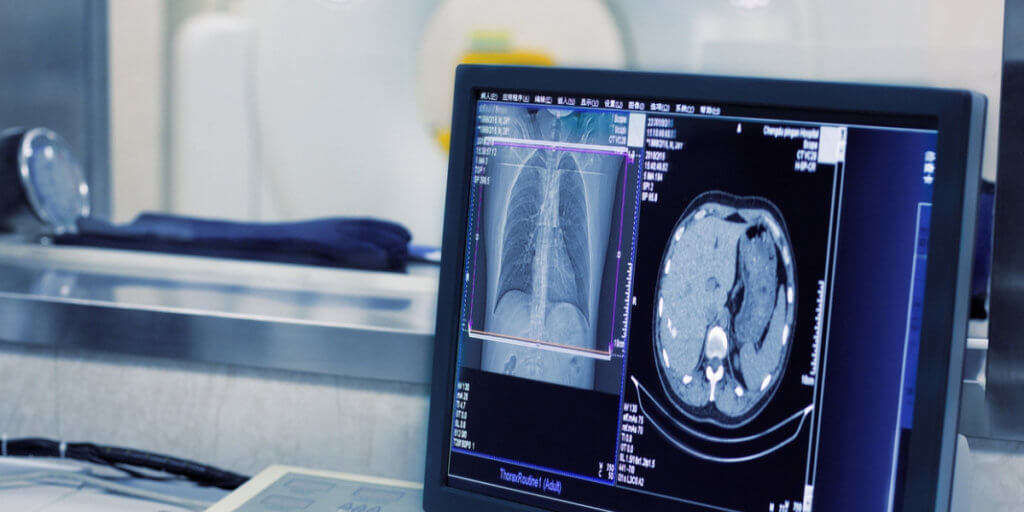 Schenectady Radiology is now part of ImageCare Medical Imaging